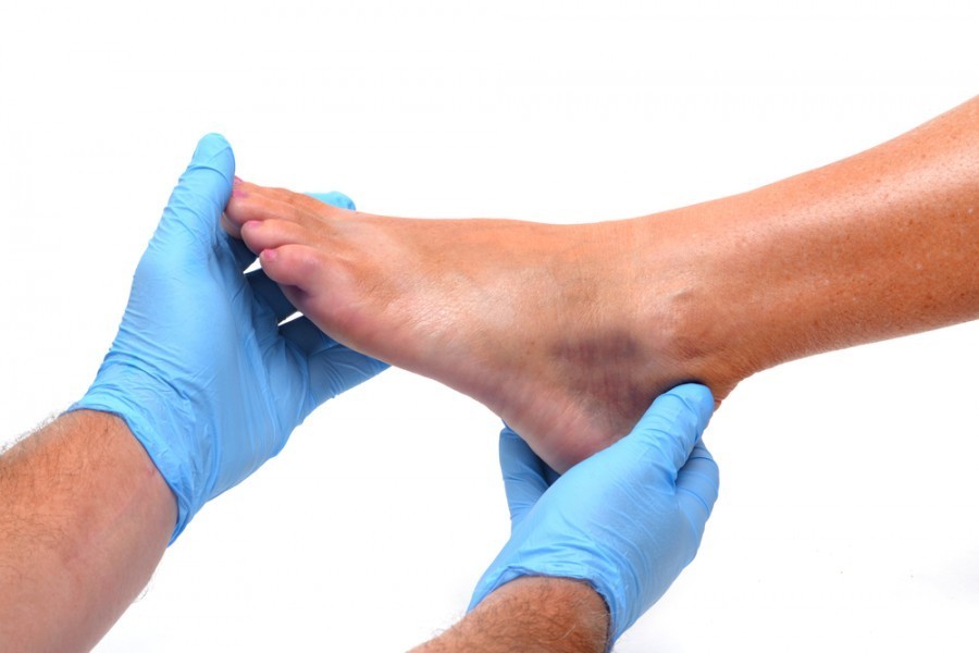 Quels sont les signes indiquant qu'une entorse du dessus du pied nécessite une consultation médicale ?